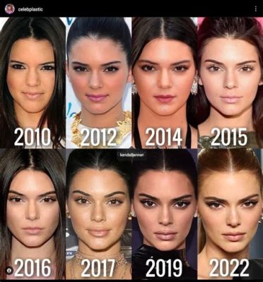 Has Kendall Jenner Ever Had Plastic Surgery? Exploring the Rumors and Realities